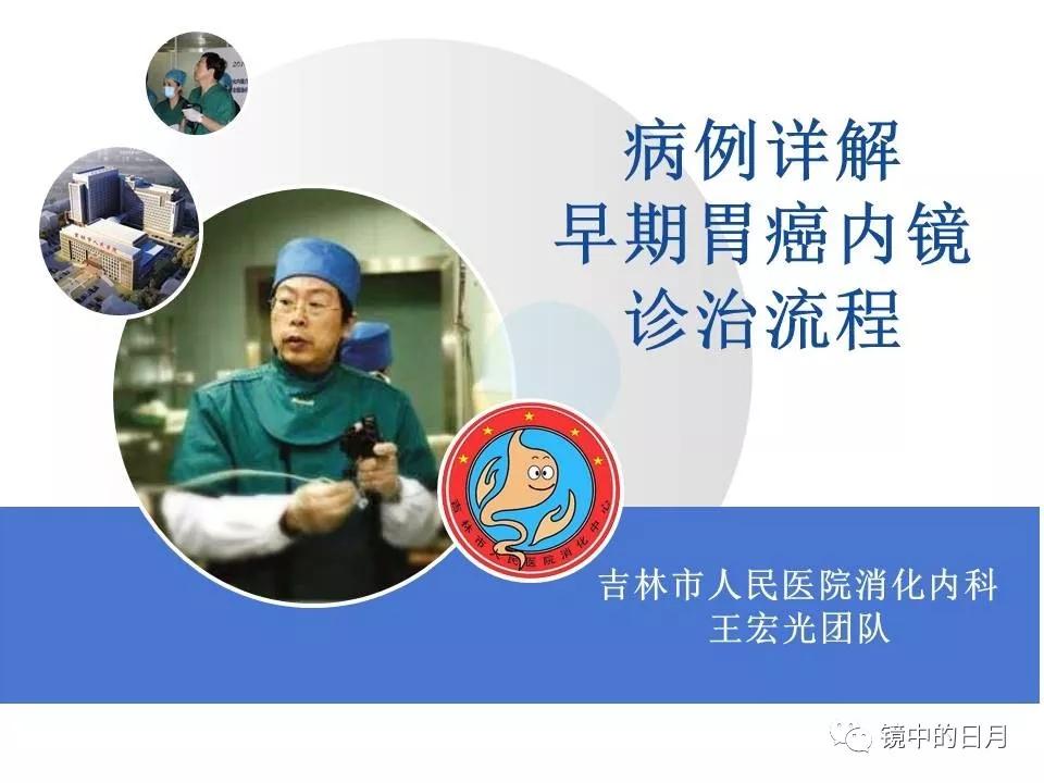 低分化胃癌早期时候做内镜手术吗,早期胃癌内镜手术后追加外科手术