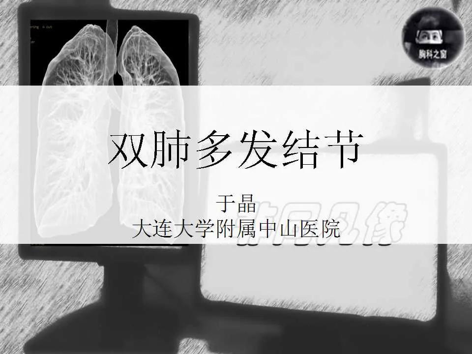 双肺多发结节是肺癌的征兆吗,双肺多发结节灶