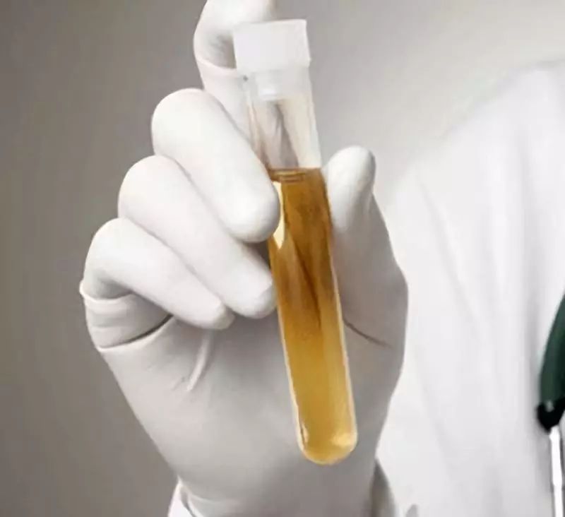 干货一图读懂体检报告单上的数值,如何看懂体检表上各项数据