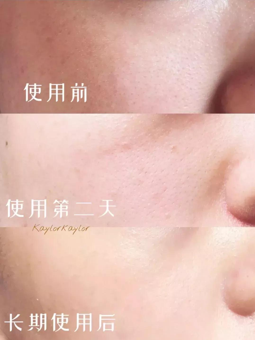 精华原液成分怎么选,精华好用的成分推荐