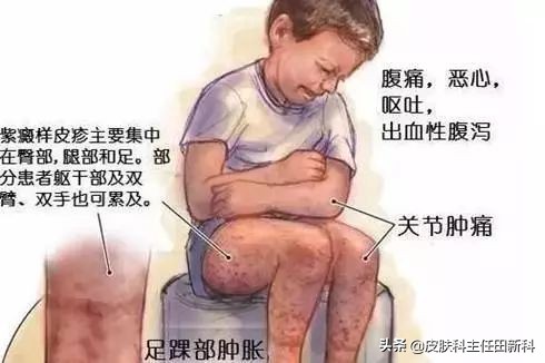 皮肤病科普系列,皮肤病科普素材