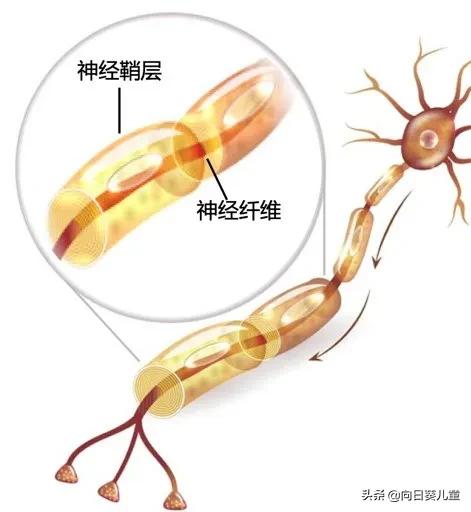 1型神经纤维瘤最佳治疗方案,神经纤维瘤最轻的是哪型