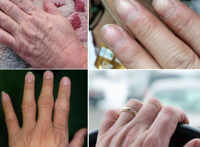 王凯手被投保3600万?林更新堵车时不忘涂手霜,我承认自己不精致