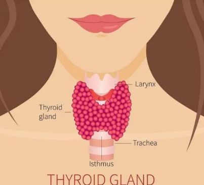 有轻微的甲状腺结节应该注意什么,出现甲状腺结节怎么办