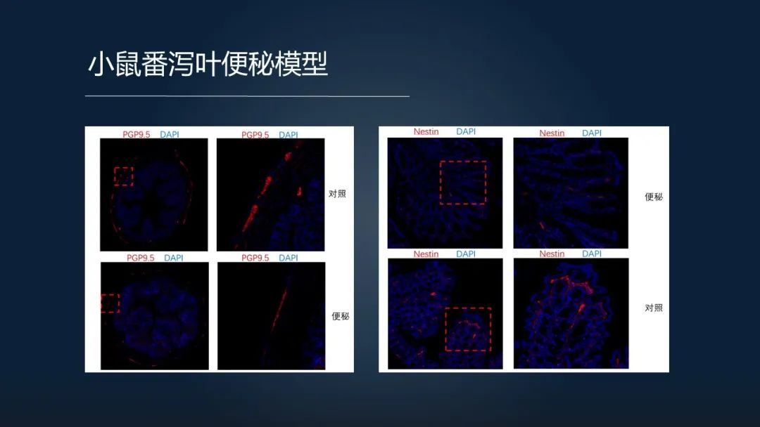 一招调理肠道改善便秘,肠道水疗治便秘有效吗