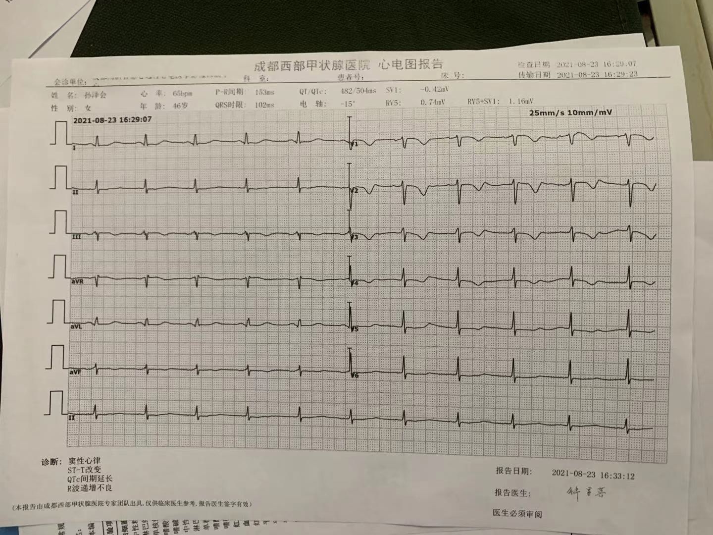 甲亢致人死亡,甲亢实际案例