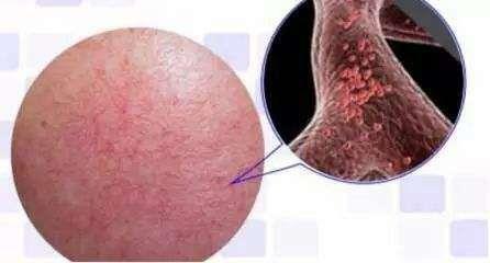 皮肤过敏红肿痒怎么解决,皮肤受损起皮泛红刺痛怎么办