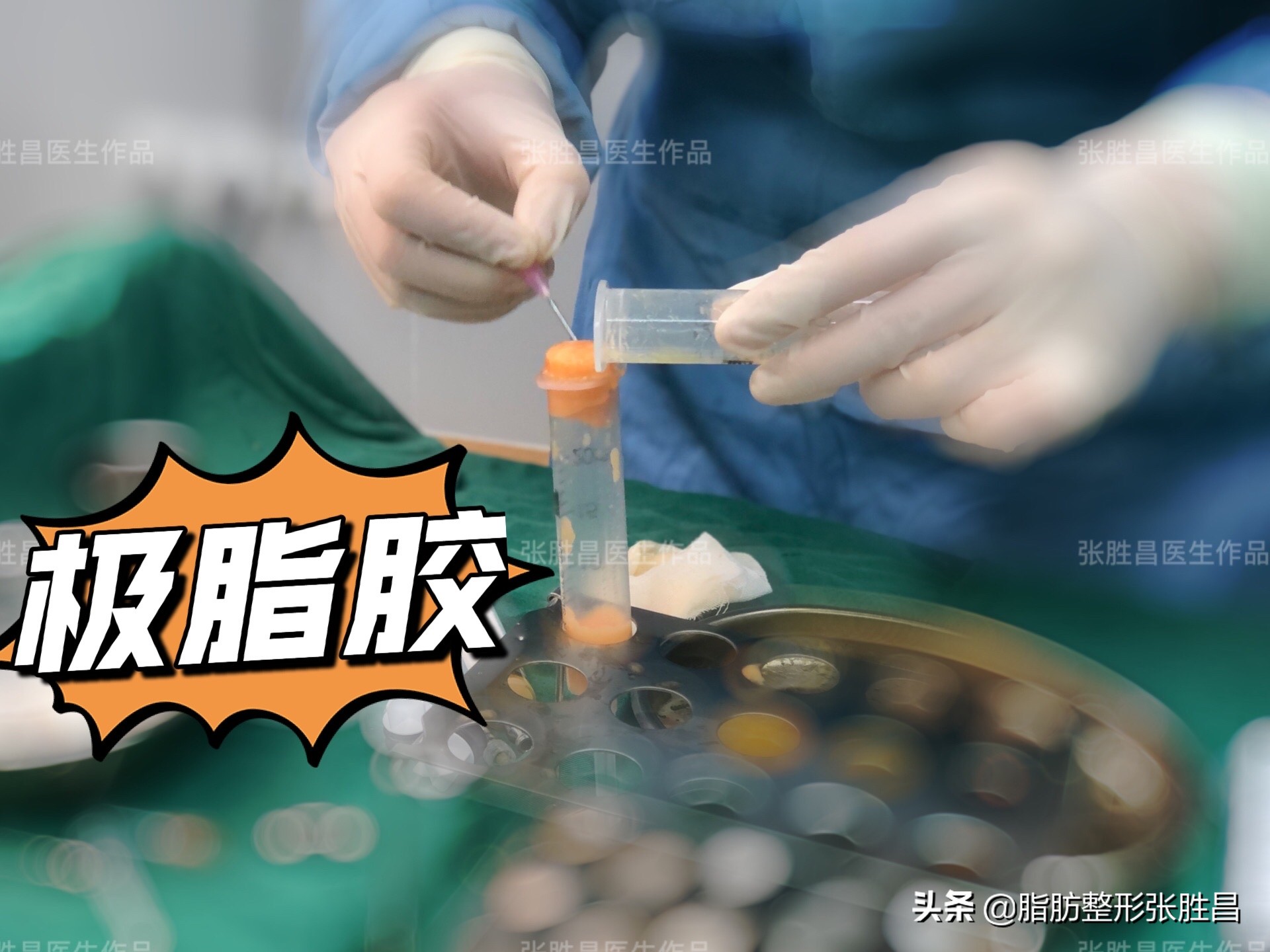 自体脂肪面部填充效果能保持多久,用自体脂肪面部填充怎样才算成功