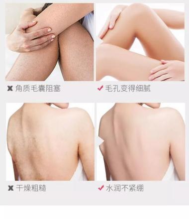 日本去螨虫皂,日本小黑皂号称螨虫克星