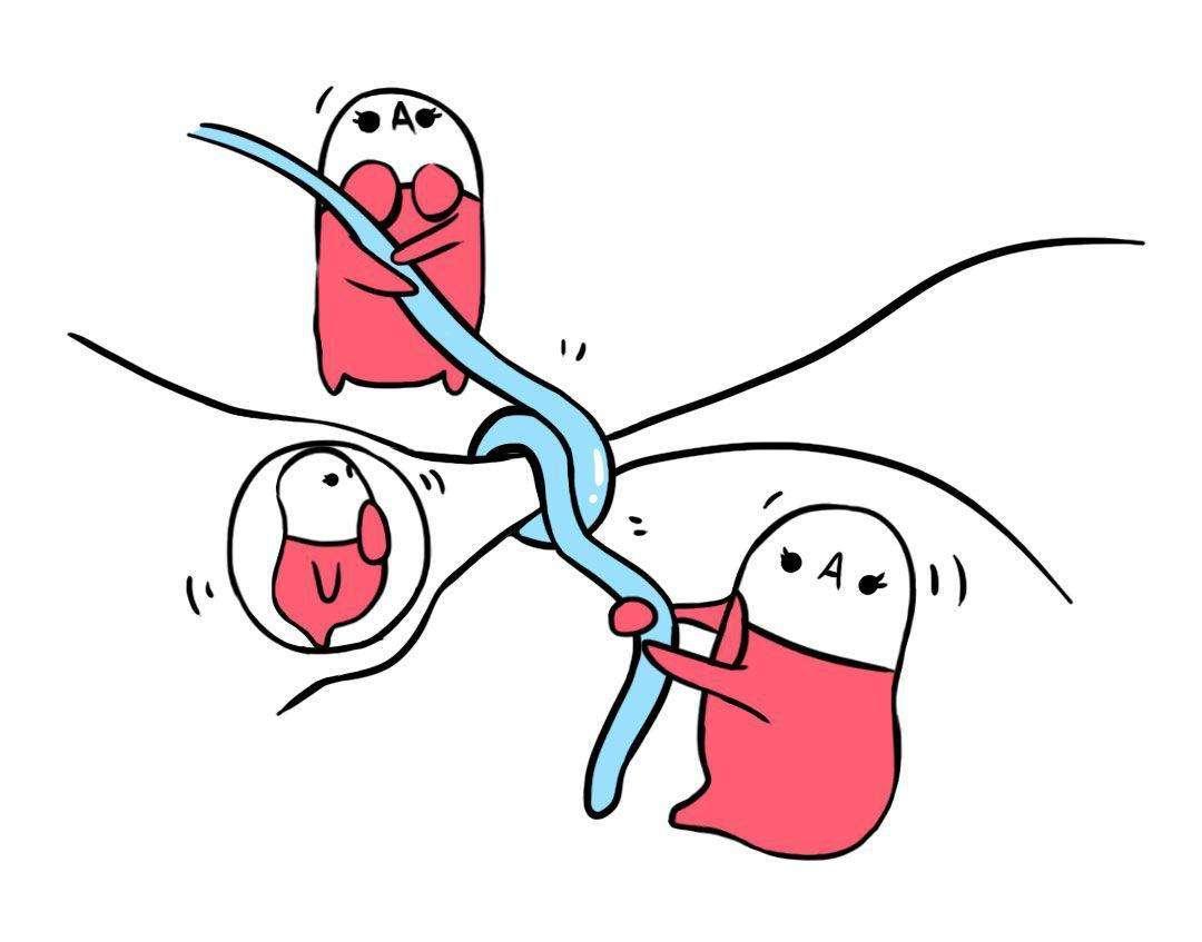 慢性阴道炎和上环有关系吗,上环了还会宫外孕怎么治