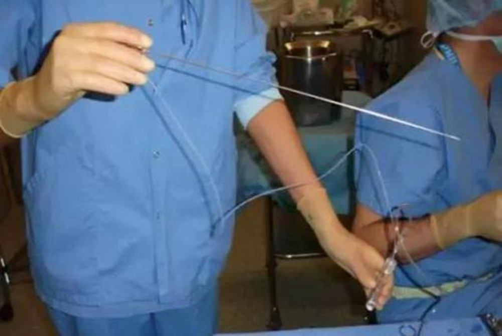 90后试管心酸过程,90后小夫妻的试管之路