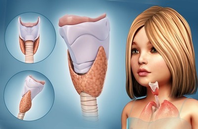 甲状腺肿大如何治疗效果好,甲状腺肿大治疗最好的办法