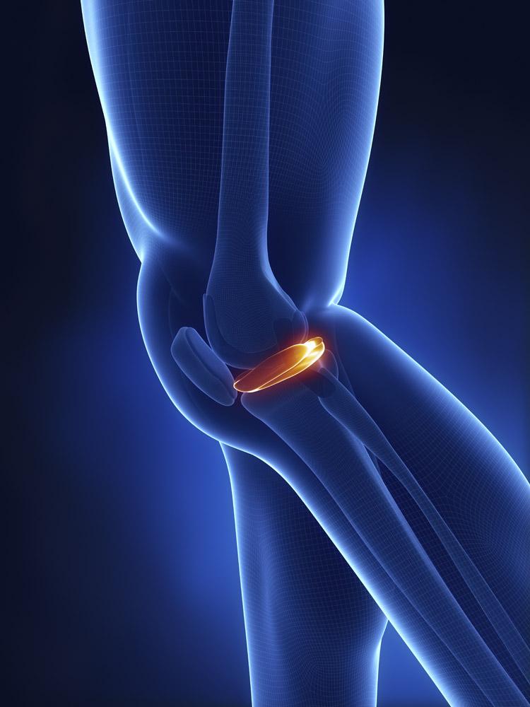 腘肌与膝盖疼痛,膝盖的腘肌