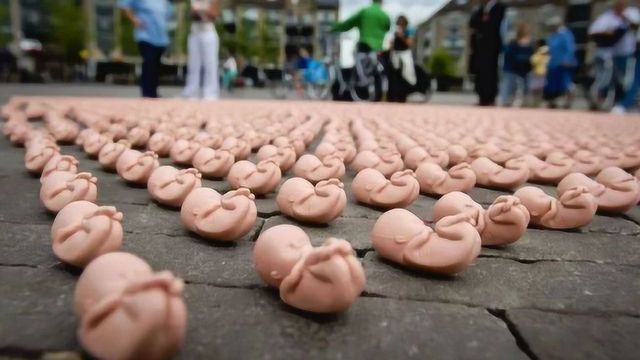 羊水过少的原因及处理方法,羊水多和羊水少都有啥危害