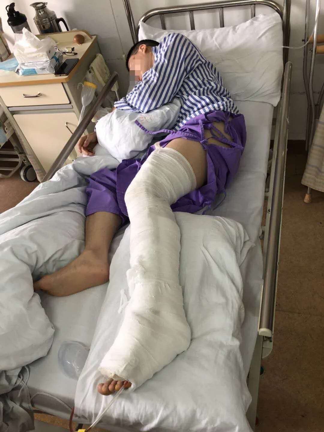 “我要减肥”！杭州33岁小伙儿连打四天羽毛球后，“脚筋”断了……