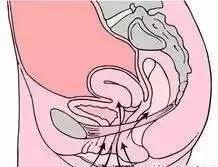 盆底修复可以改善哪些,盆底修复从什么时候开始