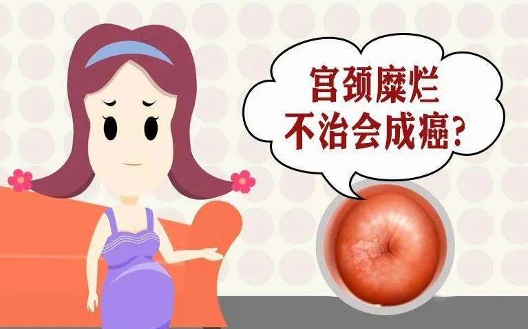 宫颈脱垂症状,宫颈下垂症状