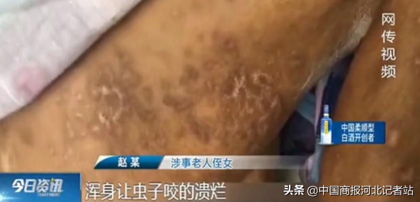 养老院老人长蛆事件,敬老院老人长蛆