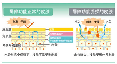 疫情期间手痒怎么治,疫情期间频繁洗手手脱皮