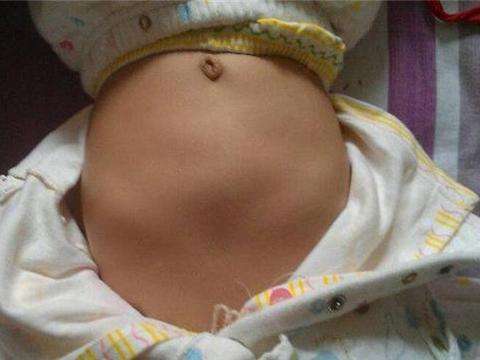 十个月宝宝肋骨外翻正常吗,生宝宝后肋骨外翻怎么矫正