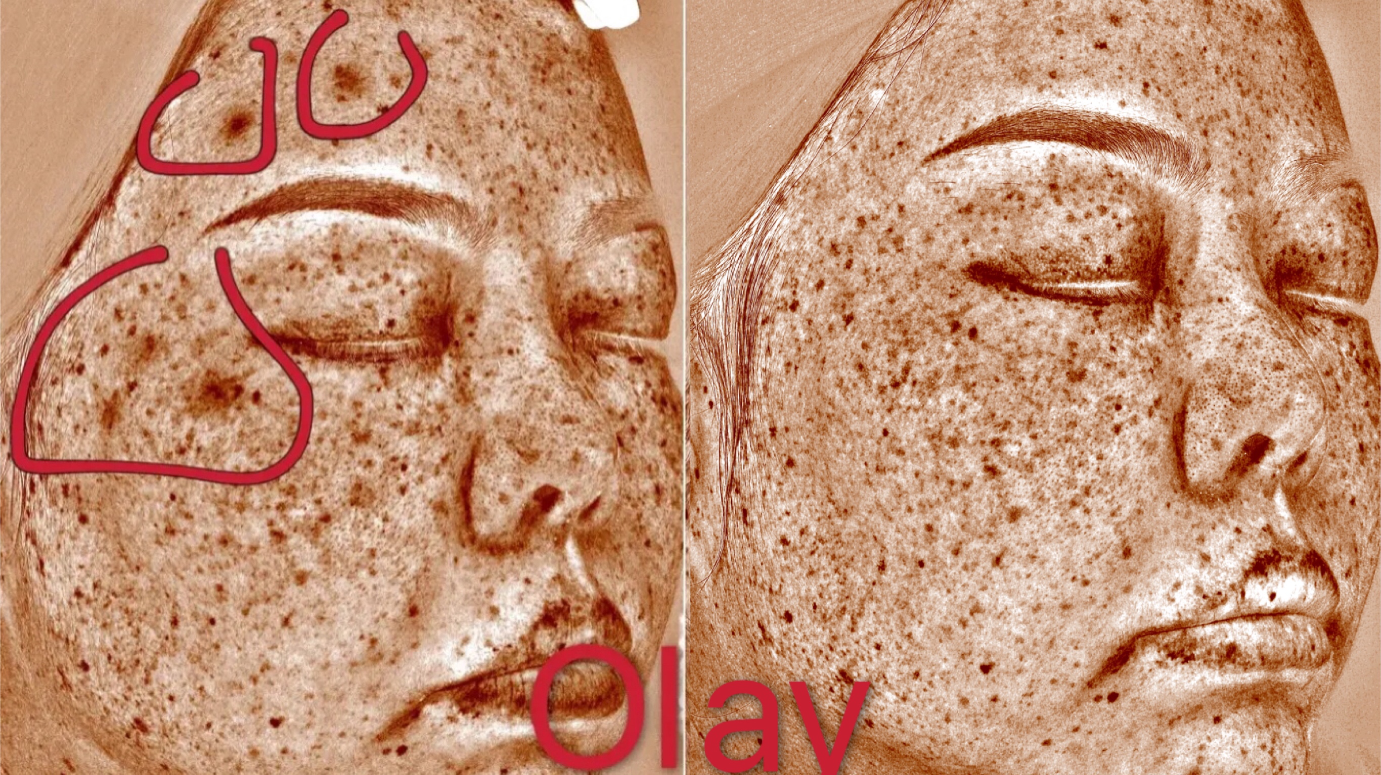 玉兰油小白瓶和olay小白瓶,sk2小灯泡和玉兰油小白瓶哪个好