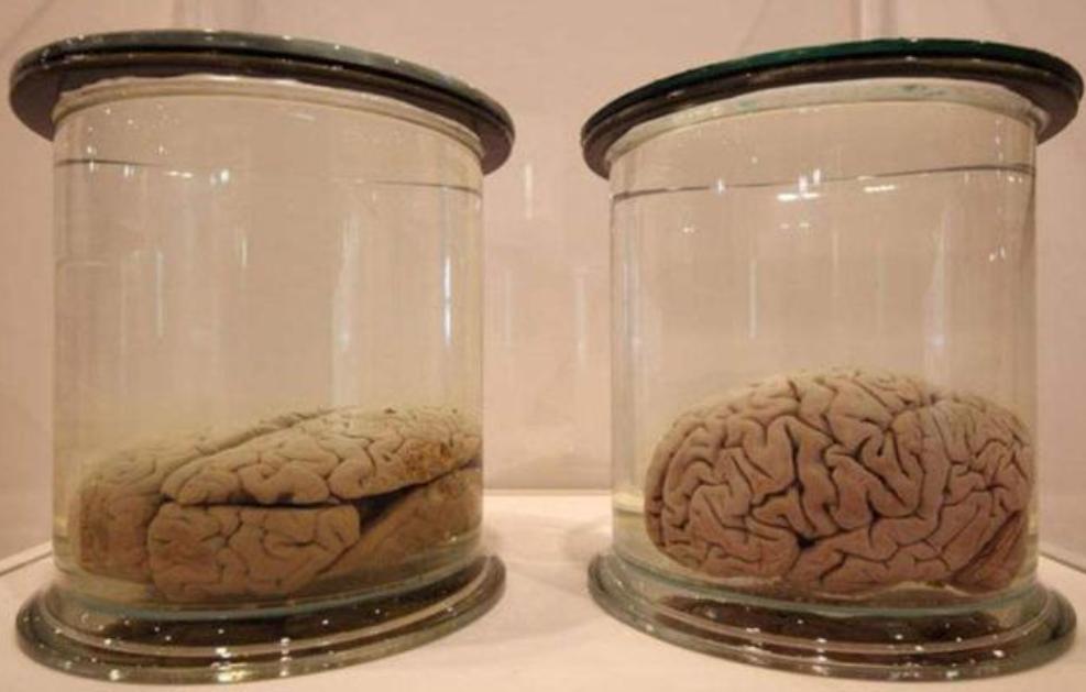 爱因斯坦死后的大脑被人偷走了吗,爱因斯坦死后大脑竟然被保留