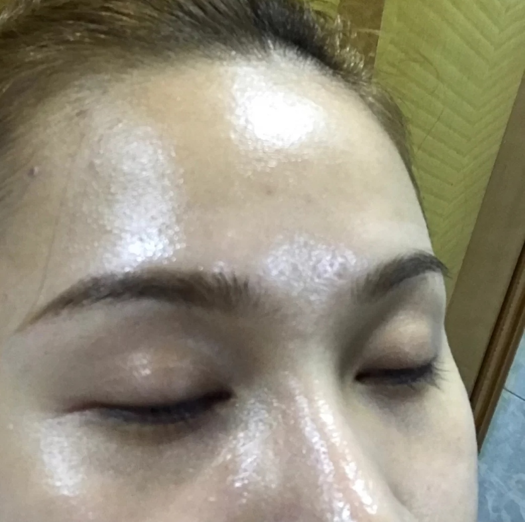 油性皮肤更抗衰老吗,油性皮肤保湿有用吗