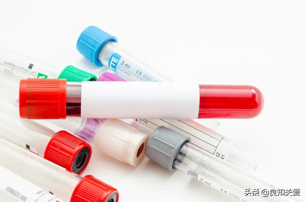 血脂化验单没有也不可大意,一张图看懂高血脂