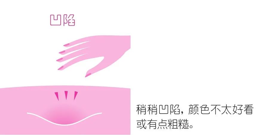 angelababy使用的膏药,angelababy颈部按摩