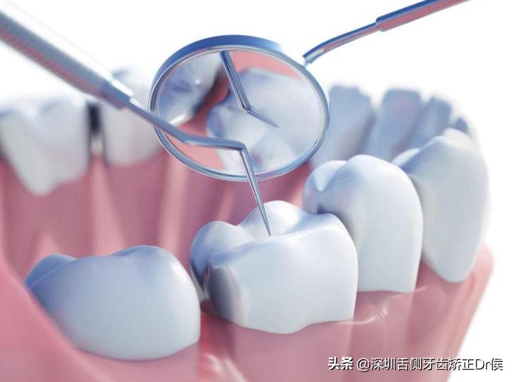 牙齿牙根没长全该怎样护理,《牙齿》护理攻略