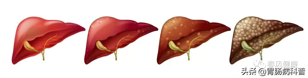 癌前病变虽不是癌症，但这8种情况一定别轻视