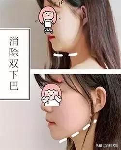 小红书变美捷径,小红书上的变美方法可靠吗