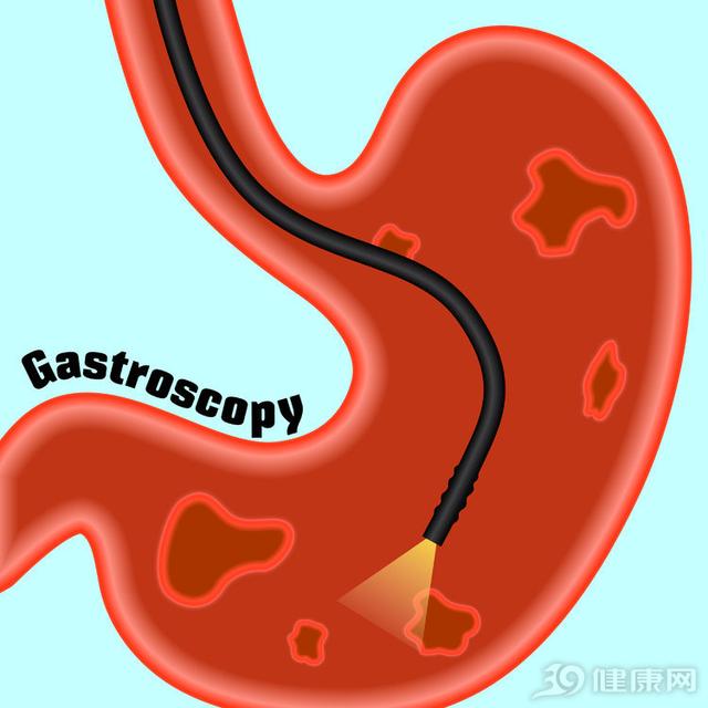 做一般胃镜检查前应注意哪些方面,胃镜检查具体是怎么做的