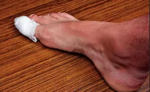 糖尿病人如何选购适合的鞋子,糖尿病患者如何选择鞋