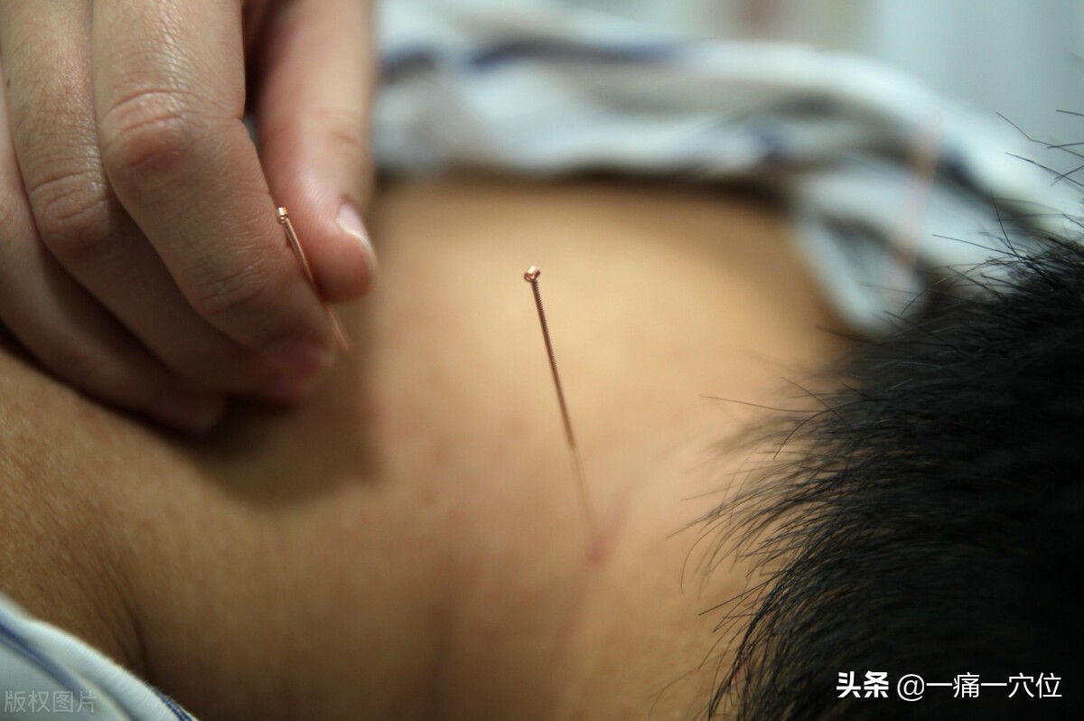 头顶疼痛怎么治疗最快最有效,头顶痛的最佳解决办法