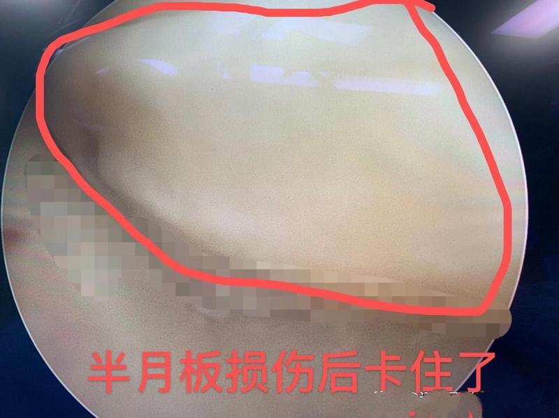 膝关节卡住能自愈吗,膝关节卡住了疼痛怎么办