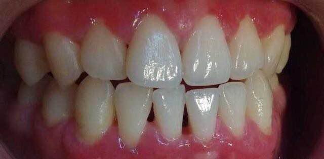 口腔医学医者仁心,口腔医学的工匠精神