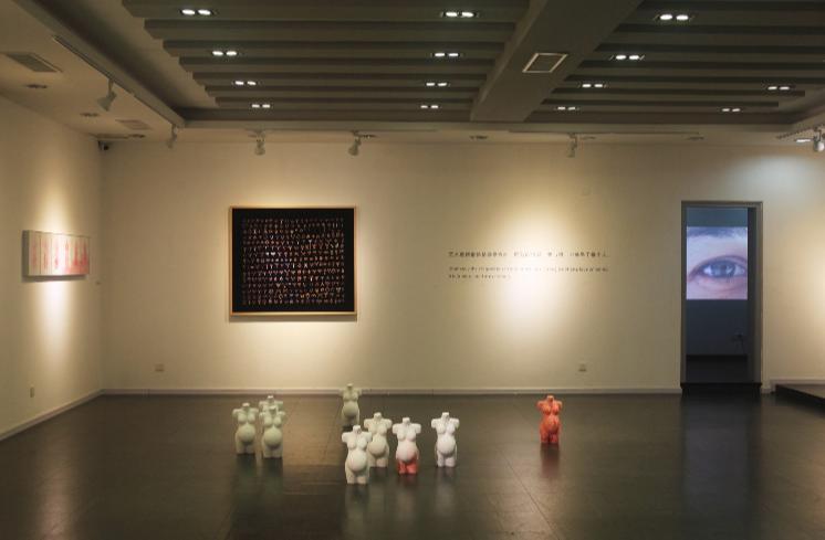 节育环在身体里40年了,遗忘在妈妈体内的节育环