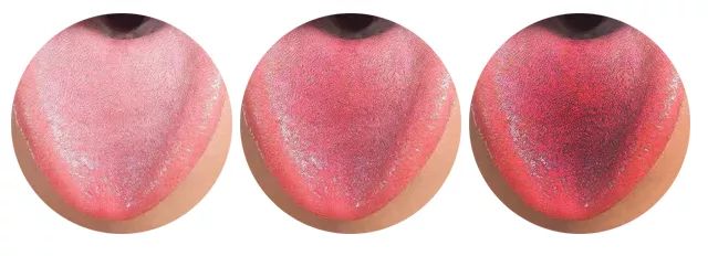 望舌知病实操完整版,教你看舌辨病