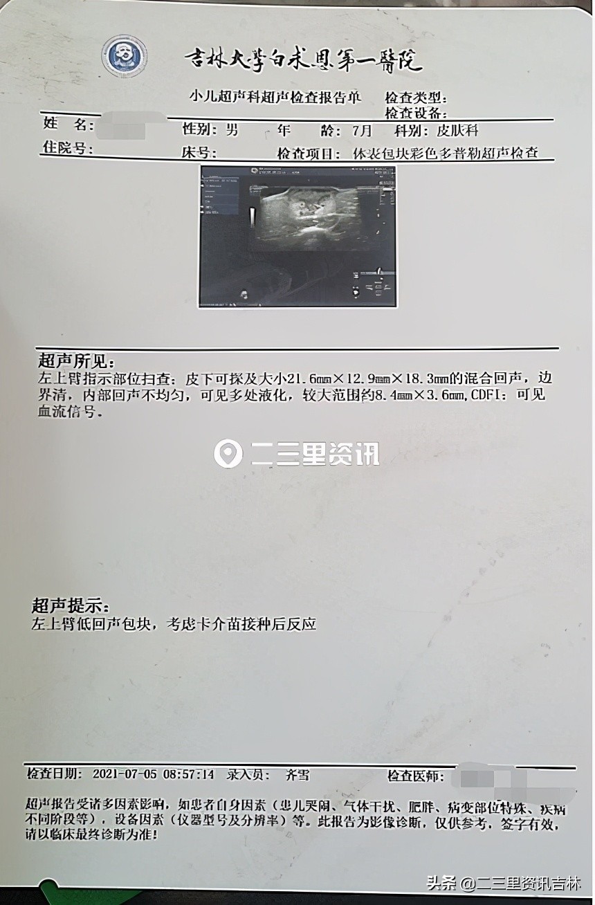 小孩接种卡介苗一年半后红肿痒,打卡介苗50天后化脓红肿怎么护理