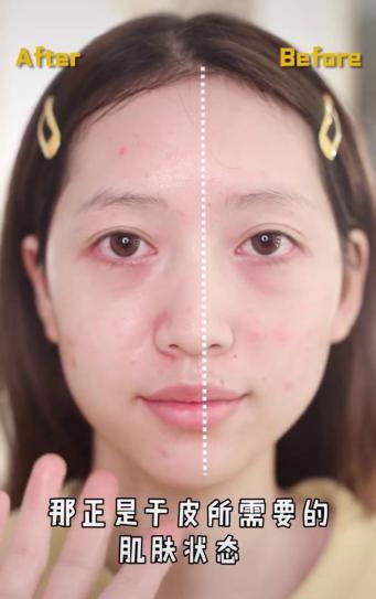 干皮如何避免底妆很快氧化暗沉,干皮如何化底妆遮盖雀斑