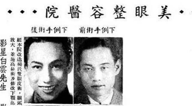 中国哪家整容医院割双眼皮好,上海哪家整容医院做双眼皮最好