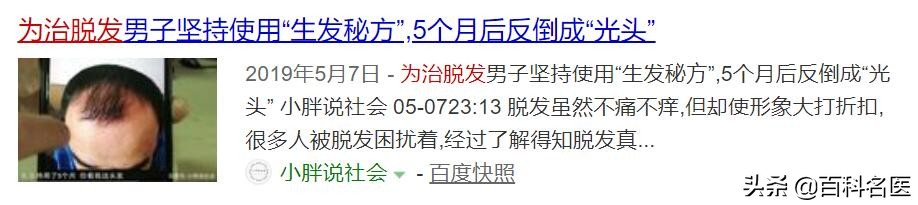 脱发自救神器,脱发自救指南电子书