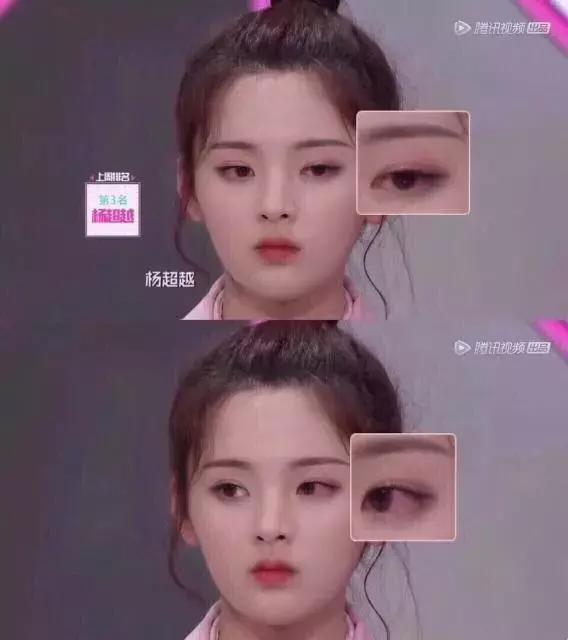 青少年女生戴美瞳会影响眼睛视力 (女生戴美瞳的后果导致眼睛失明)