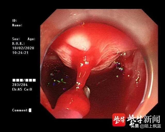 一女子吃馒头吐血,女子吃馒头吐血