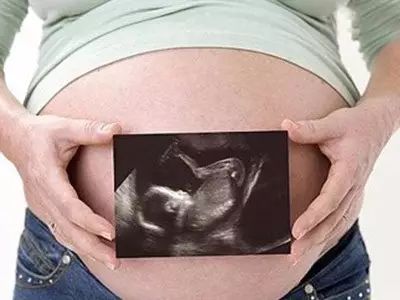 胎儿左右心室有强光斑是什么原因,胎儿左右心室有强光斑注意事项