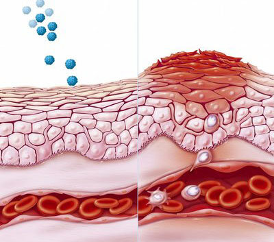 经常使用含酸的护肤品有什么危害,常见含有酸的护肤品有哪些