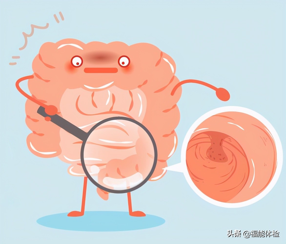 肠息肉切除后多久复查一次肠镜,肠息肉切除后多久复查一次