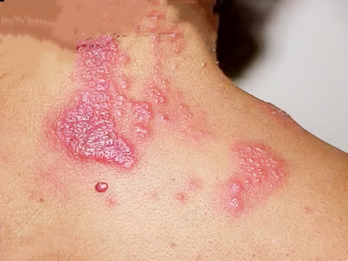 老人有高血压突然头痛是怎么回事,高血压头痛和一般头痛的区别