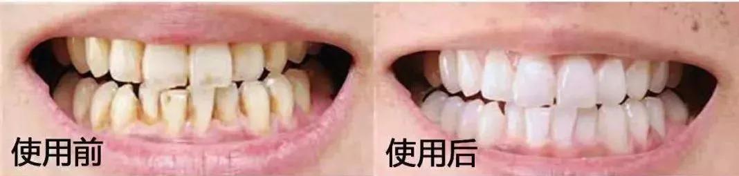 真正能把牙齿刷白的牙膏测评,进口去牙渍牙垢牙黄的牙膏第一名